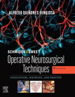 Schmidek and Sweet: Operative Neurosurgical Techniques: Indications, Methods and Results